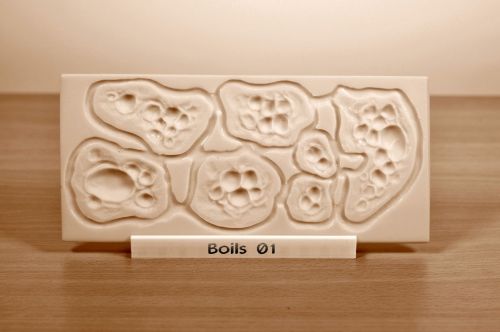Prosthetic mould Boils 01