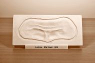 Prosthetic mould Low brow 01