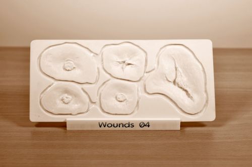 Prosthetic mould Wounds 04